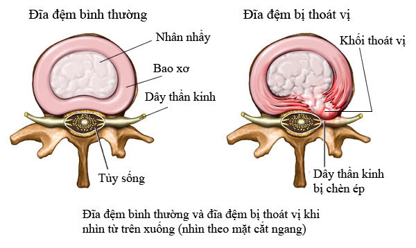 thoat-vi-dia-dem-rach-bao-xo